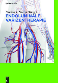 Title: Endoluminale Varizentherapie, Author: Florian Johannes Netzer