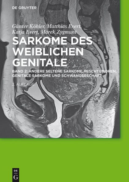 Andere seltene Sarkome, Mischtumoren, genitale Sarkome und Schwangerschaft