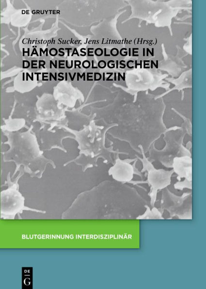 Hämostaseologie in der neurologischen Intensivmedizin