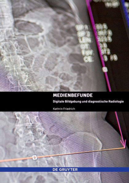 Medienbefunde: Digitale Bildgebung und diagnostische Radiologie