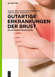 Title: Gutartige Erkrankungen der Brust: Ein Leitfaden für die Praxis, Author: Johannes Stubert