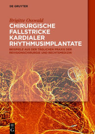 Title: Chirurgische Fallstricke kardialer Rhythmusimplantate: Beispiele aus der täglichen Praxis der Revisionschirurgie und Rechtsmedizin, Author: Brigitte Osswald