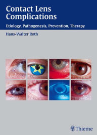 Title: Contact Lens Complications: Etiology, Pathogenesis, Prevention, Therapy, Author: Hans-Walter Roth