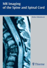 Title: MR Imaging of the Spine and Spinal Cord, Author: Detlev Uhlenbrock