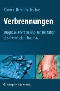 Verbrennungen: Diagnose, Therapie und Rehabilitation des thermischen Traumas / Edition 1