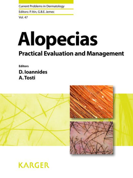 Alopecias - Practical Evaluation and Management