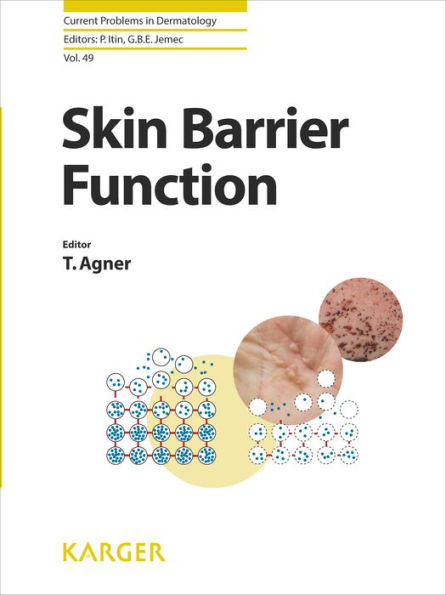 Skin Barrier Function