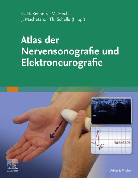 Atlas der Nervensonografie und Elektroneurografie