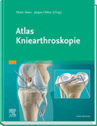 Title: Atlas Kniearthroskopie, Author: Dieter Rixen