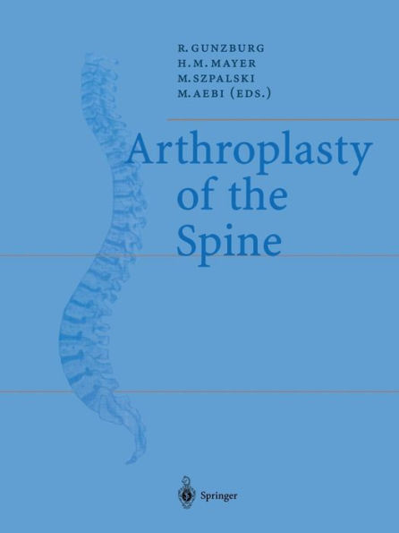 Arthroplasty of the Spine / Edition 1