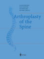 Arthroplasty of the Spine / Edition 1