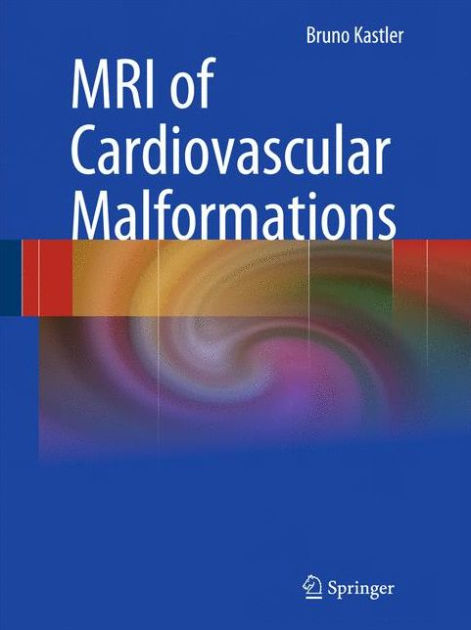 Mri Of Cardiovascular Malformations   Edition 1 By Bruno Kastler 