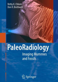 Paleoradiology: Imaging Mummies and Fossils / Edition 1