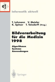 Title: Bildverarbeitung fï¿½r die Medizin 1998: Algorithmen - Systeme - Anwendungen Proceedings des Workshops am 26. und 27. Mï¿½rz 1998 in Aachen, Author: Thomas Lehmann