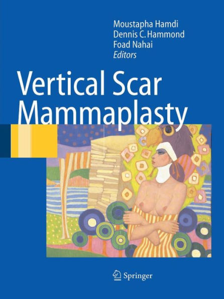 Vertical Scar Mammaplasty / Edition 1