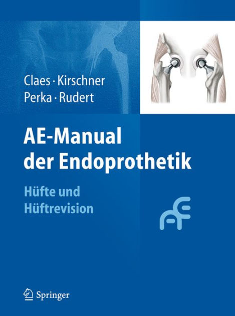 AE-Manual Der Endoprothetik: Hüfte Und Hüftrevision By Lutz Claes ...