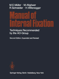 Title: Manual of Internal Fixation: Techniques Recommended by the AO Group, Author: Maurice E. Müller
