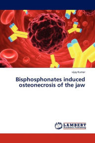 Title: Bisphosphonates induced osteonecrosis of the jaw, Author: Kumar Vijay