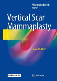 Title: Vertical Scar Mammaplasty / Edition 2, Author: Moustapha Hamdi