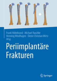 Title: Periimplantäre Frakturen, Author: Frank Hildebrand