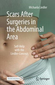Title: Scars After Surgeries in the Abdominal Area: Self-Help with the Liedler-Concept, Author: Michaela Liedler