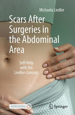 Scars After Surgeries in the Abdominal Area: Self-Help with the Liedler-Concept