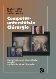 Title: Computerunterstützte Chirurgie: Medizinische und informatische Aspekte am Beispiel einer Pilotstudie, Author: Stephen Fedtke