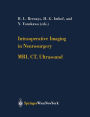 Intraoperative Imaging in Neurosurgery: MRI, CT, Ultrasound