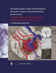 Title: Neurosurgery of Arteriovenous Malformations and Fistulas: A Multimodal Approach, Author: Robert Schmid-Elsaesser