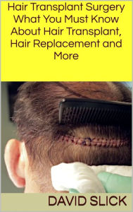 Title: Hair Transplant Surgery: What You Must Know About Hair Transplant, Hair Replacement and More, Author: David Slick