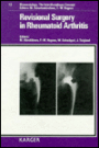 Revisional Surgery in Rheumatoid Arthritis