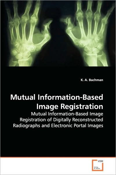 Mutual Information-Based Image Registration By K. A. Bachman ...