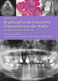 Title: Bisphosphonat-induzierte Osteonekrose der Kiefer: Ätiologie, Prävention, Behandlung, Author: Robert E. Marx
