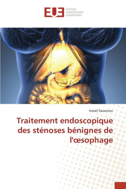 Traitement Endoscopique Des St Noses B Nignes De L Osophage By Ismail