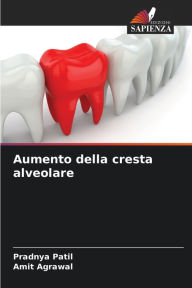 Title: Aumento della cresta alveolare, Author: Pradnya Patil