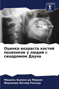 Title: Оценка возраста костей позвонков у людей 
, Author: Мише Бьянки де Мораес