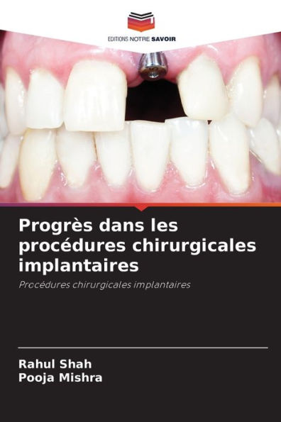 Progrï¿½s dans les procï¿½dures chirurgicales implantaires