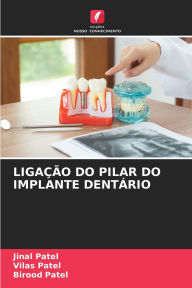 Title: Ligaï¿½ï¿½o Do Pilar Do Implante Dentï¿½rio, Author: Jinal Patel