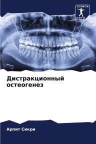 Title: Дистракционный остеогенез, Author: Арпит Сикри