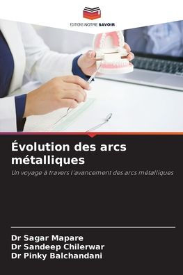 ï¿½volution des arcs mï¿½talliques
