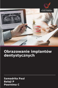 Title: Obrazowanie implantï¿½w dentystycznych, Author: Samadrita Paul