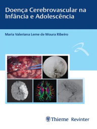 Title: Doença Cerebrovascular na Infância e Adolescência, Author: Maria Valeriana Leme de Moura Ribeiro
