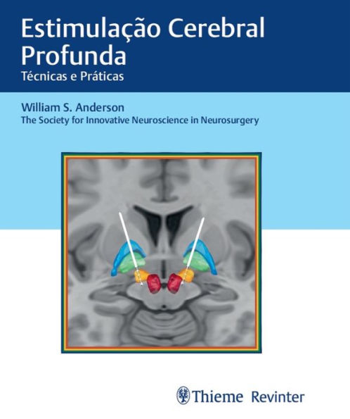 Estimulação Cerebral Profunda: Técnicas e Práticas