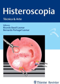 Title: Histeroscopia: Técnica & Arte, Author: Ricardo Bassil Lasmar