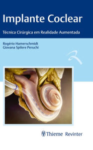 Title: Implante Coclear: Técnicas Cirúrgica em Realidade Aumentada, Author: Rogério Hamerschmidt