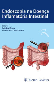 Title: Endoscopia na Doença Inflamatória Intestinal, Author: Cristina Flores