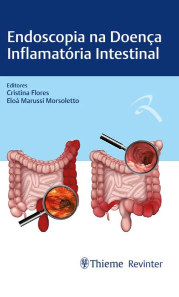 Endoscopia na Doença Inflamatória Intestinal