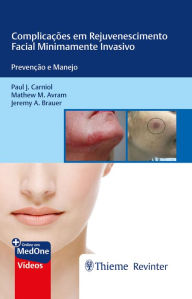 Title: Complicações em Rejuvenescimento Facial Minimamente Invasivo: Prevenção e Manejo, Author: Paul J. Carniol