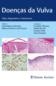 Title: Doenças da Vulva: Atlas, Diagnóstico e Tratamento, Author: Gutemberg Almeida