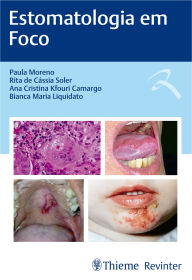 Title: Estomatologia em Foco, Author: Paula Moreno